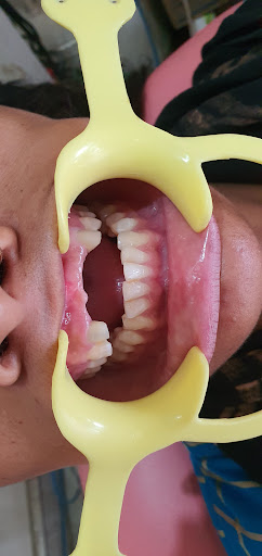 Dr. Rajesh Trivedi- Dentist in Pali