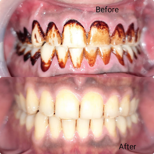 WADIA DENTAL CARE|Family and Cosmetic Dentistry|PORBANDAR.
