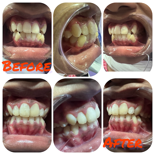 Viji dental care
