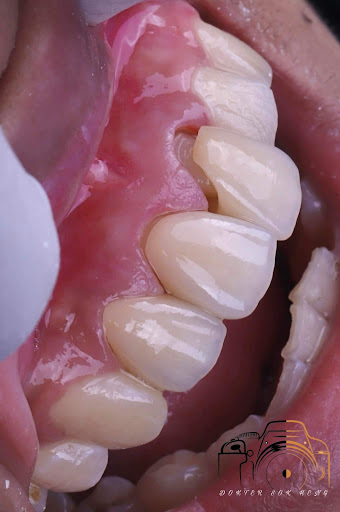 Sehgal dental clinic pathankot since 1960 Sehgal dental clinic pathankot since 1960