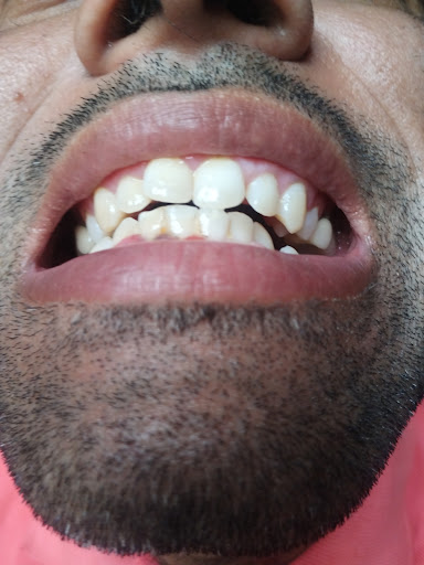 Maxdent Multi Speciality Dental Clinic