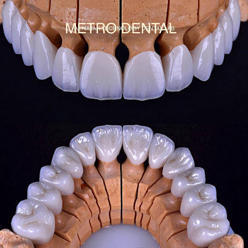 Metro Dental Clinic