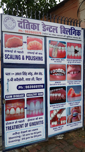 Dantika Dental Clinic - Best Dental Care In Gaya