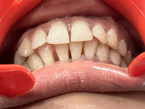 Dr Duhan & Dr Parul’s DENTAL Theatre