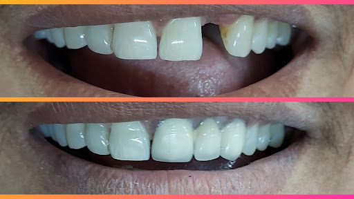 Perfect Dental and Implant Clinic - Best Dentist in Muzaffarpur | Dental Implants in Muzaffarpur