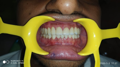 SUNCITY SECTOR DENTAL CLINIC AND ADVANCED IMPLANT CENTRE