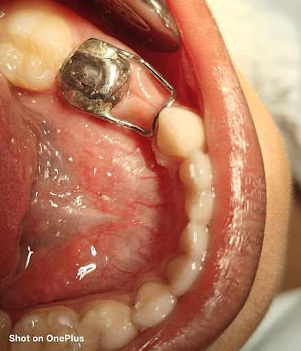 BISMIDENTAL CLINIC MALAPPURAM