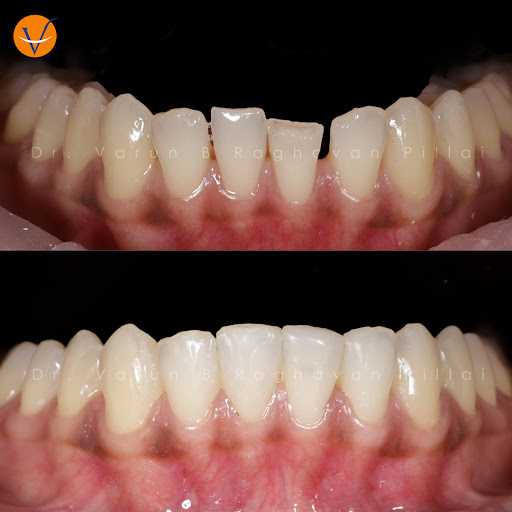 V Dentist Dental