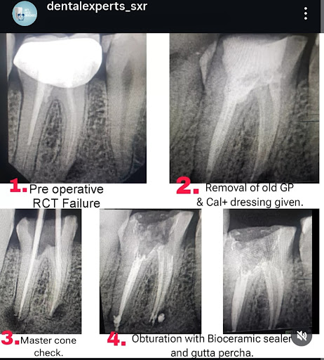 DENTAL EXPERTS | Dr Faizan Bhat | Implantologist & RCT specialist | Best dentist in srinagar | Best dental clinic