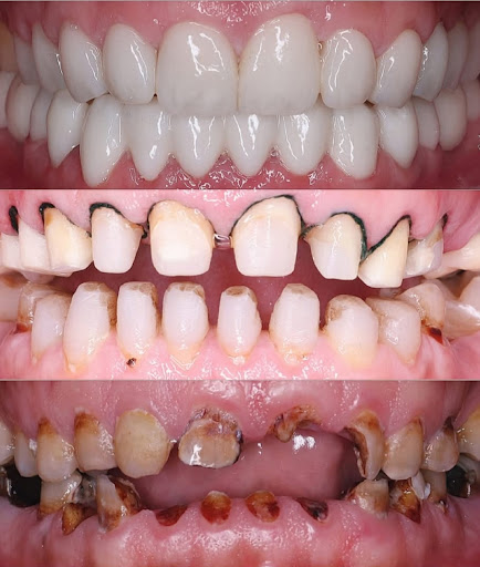 MAX DENTAL CLINIC