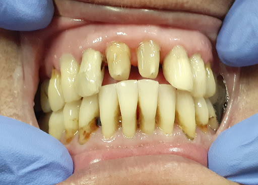 VARDHMAN DENTAL CLINIC Dr Peeush Jain - Best Good Dentist | Root Canal Treatment | Top Three Dentist in Saharanpur