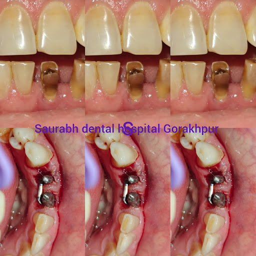 Saurabh Dental Hospital, Gorakhpur