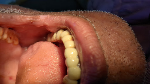 Bajrang Dental & Implant Center