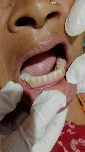 Vedanta Dental Care - Dr Swati Awasthi