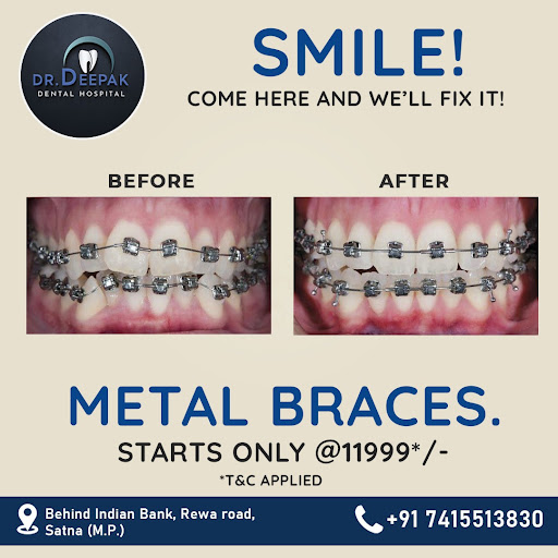 DR DEEPAK DENTAL HOSPITAL : BEST DENTAL CLINIC IN SATNA