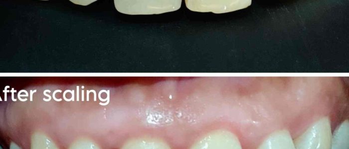 SMILE ZONE DENTAL CLINIC BRANCH 2 1 smile zone dental clinic branch 2