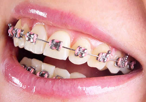 Aesthetica- Hi-tech Orthodontic Center & Multispecialty Dental Clinic, Bhavnagar