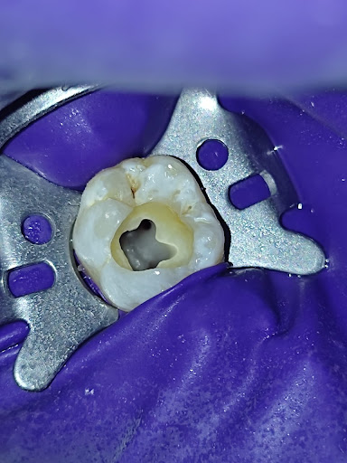 Advanced Dental Care & Implant Centre