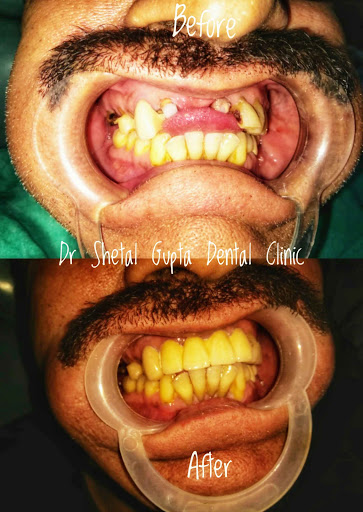 Dr Shetal Gupta Dental Clinic