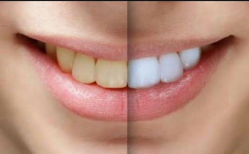 Dr Atul's Laser & Dental Implant Clinic