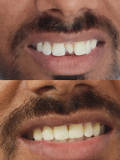 Kridha Dental Clinic ,Orthodontic And implant Center