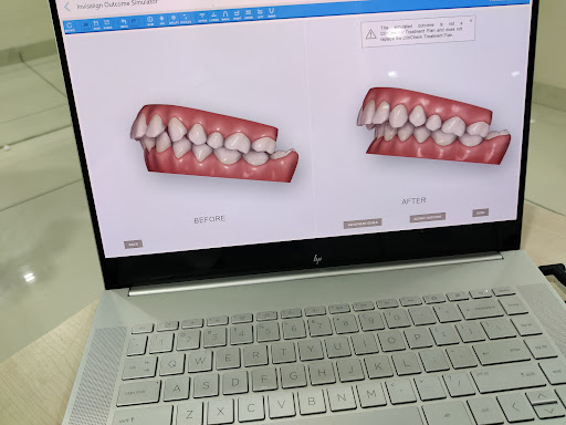 Anand Bagh Super Speciality Dental Hospital. Laser and Implant Centre