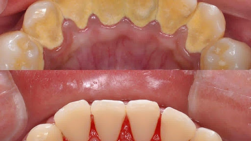 Radiance advance dentistry dental clinic