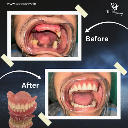 Teeth Savvy - Best Dental Clinic & Root Canal Specialist in Howrah