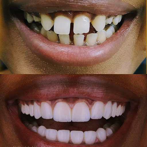 Sree Balaji Dental Clinic