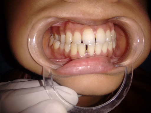 R.K Dental Clinic and Implant Center