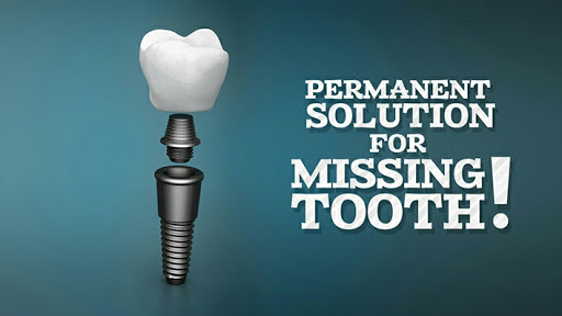 Shine Dental|Children & Adults Dental Hospital|Teeth Replacement & Implant Centre| Artificial Eyes
